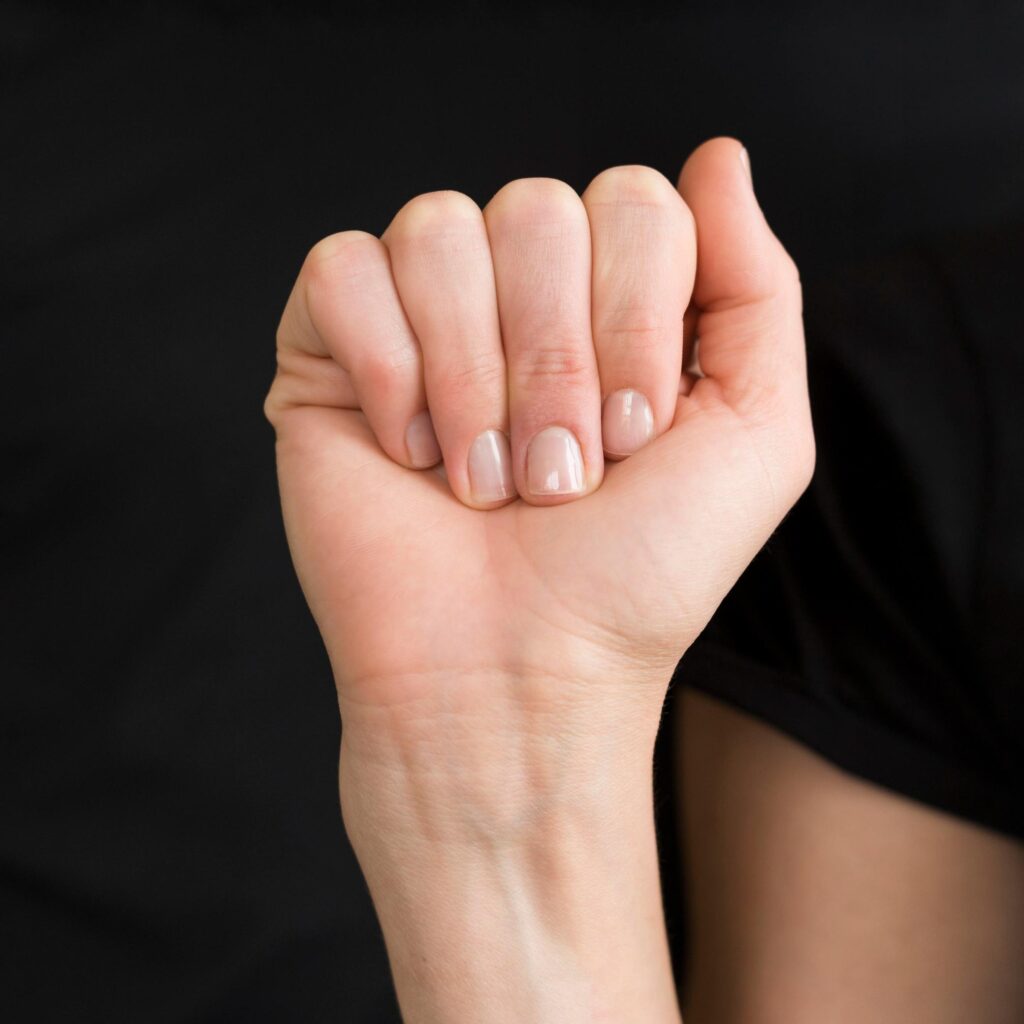 nails showing so signs of having some nail issues