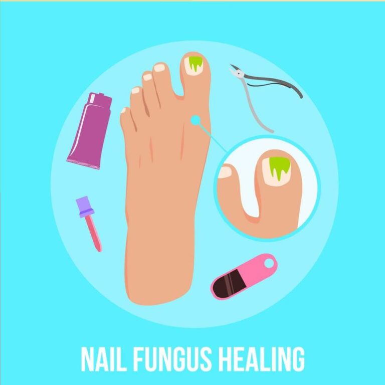Does Uv Light Kill Nail Fungus Can UV Light Kill Nail Fungus? What You Need to Know