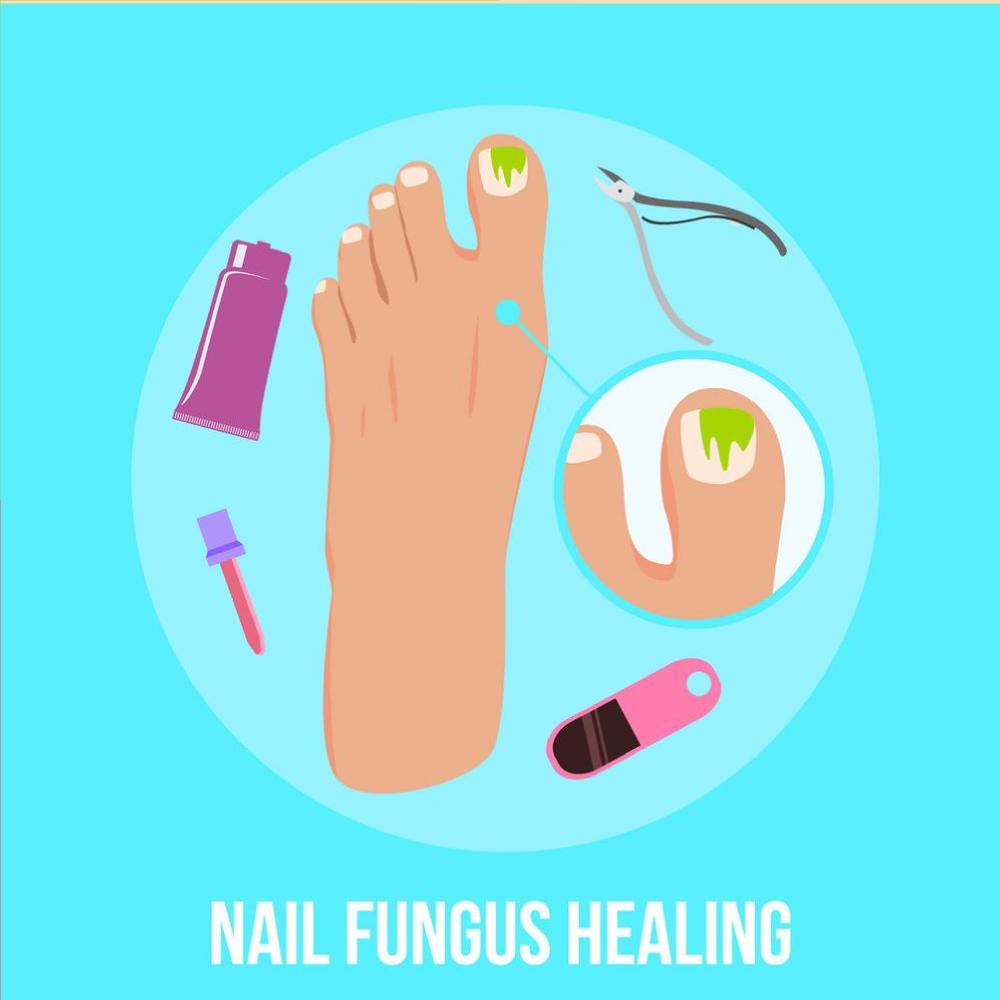 a case of nail fungus and some of the tools to cure it