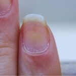 How do you Remove Yellow Stains from Nails